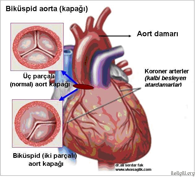 Kalp kapak sorunları, kalp yetmezliğine neden oluyor - Sağlık Haberleri